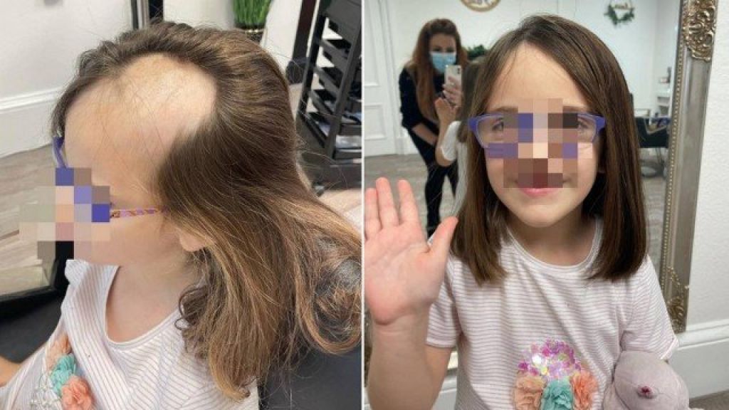 Menina Fica Calva Após Prender O Cabelo Em Batedeira E Salão Resolve O Problema Rádio 94 Fm 7078